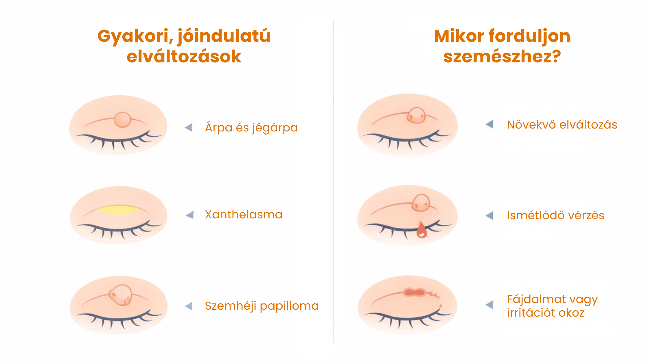 Jóindulatú és rosszindulatú elváltozások a szemen
