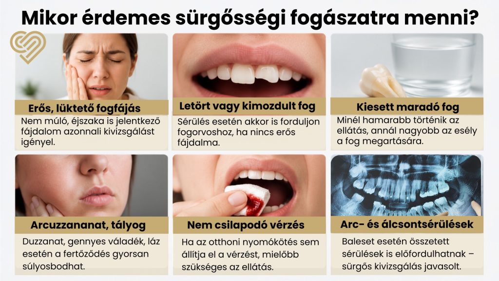Mikor érdemes sürgősségi fogászatra menni?